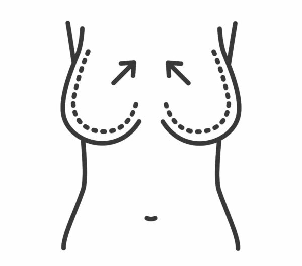 عملية تصغير الثدي - الدكتور إيهاب فضل - استشاري جراحة السمنة والمناظير - مدرس الجراحة العامة - كلية الطب جامعة عين شمس